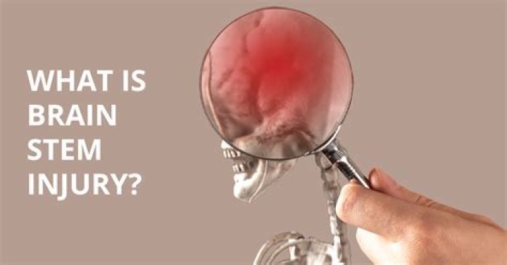 Can you live with a damaged brain stem?