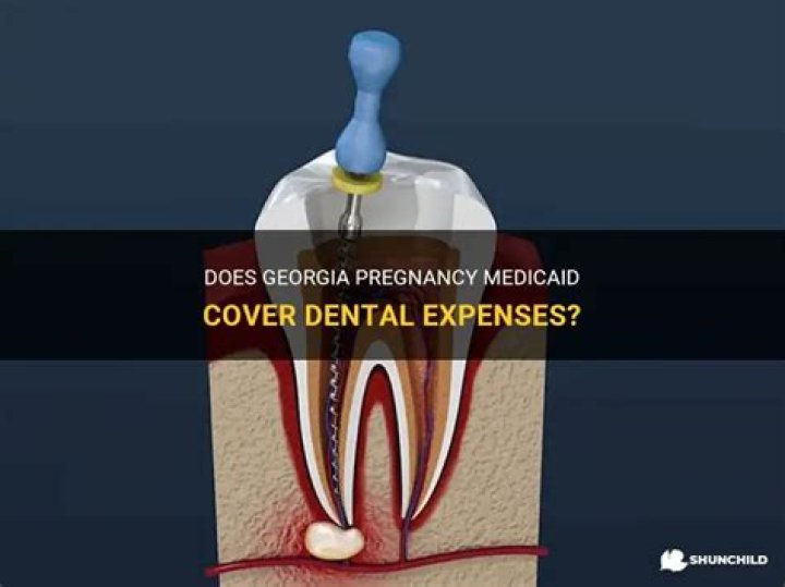 Does Georgia Pregnancy Medicaid cover dental?
