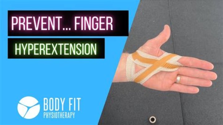 How long does it take for a hyperextended finger to heal?