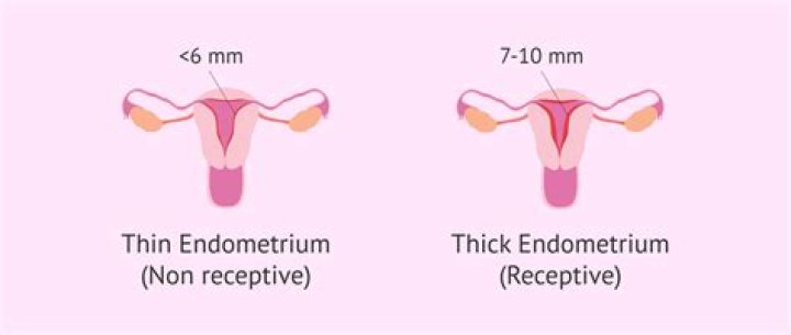 How thick should endometrial lining be after ablation?