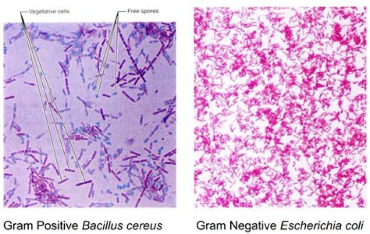 Is Bacillus circulans Gram positive or negative?