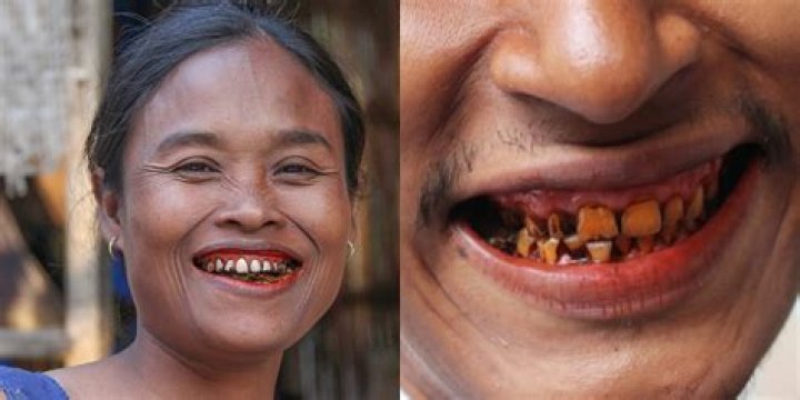 What can a fake grill do to your teeth?