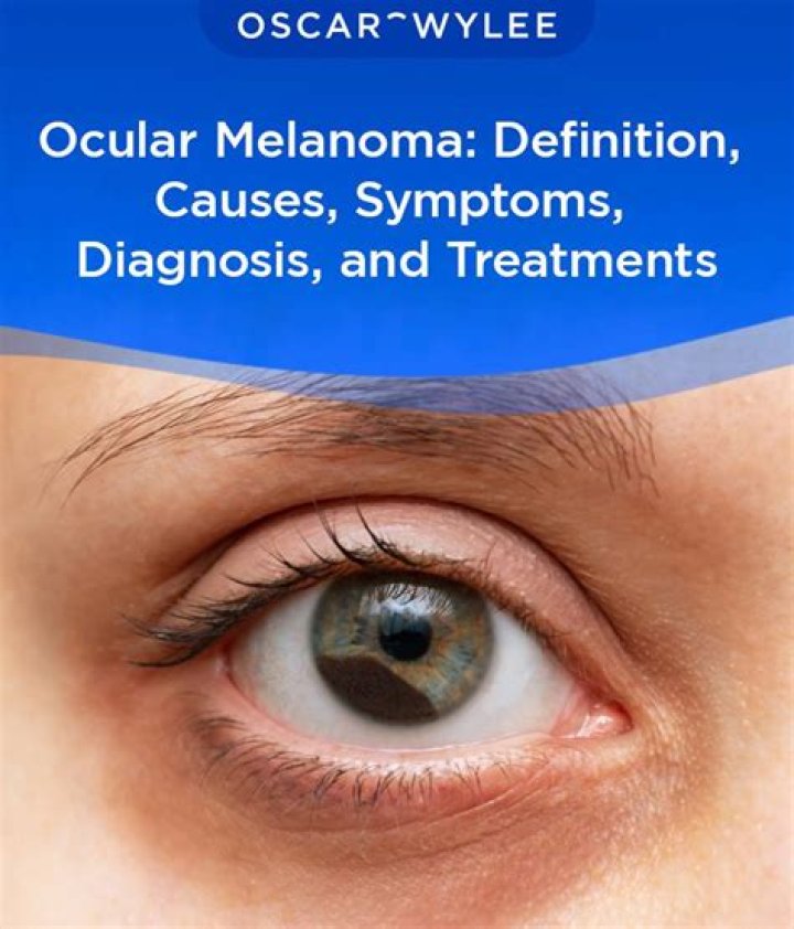 What does melanoma on the eyelid look like?