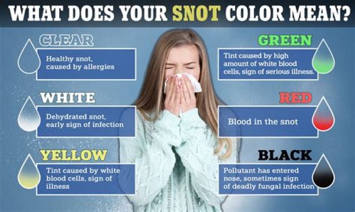 What does snot mean in a dream?