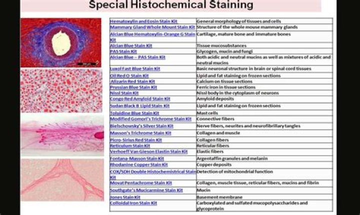 What is a histochemical stain?