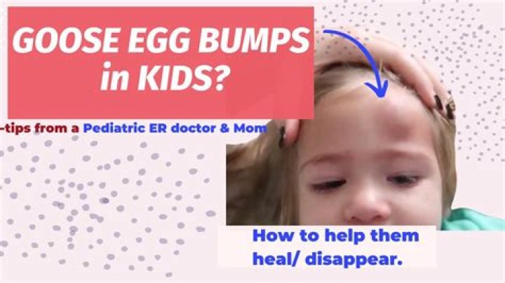 What is another word for goose egg?