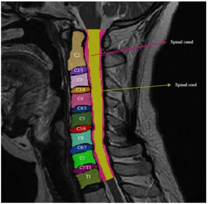 What is C3 C6 support?