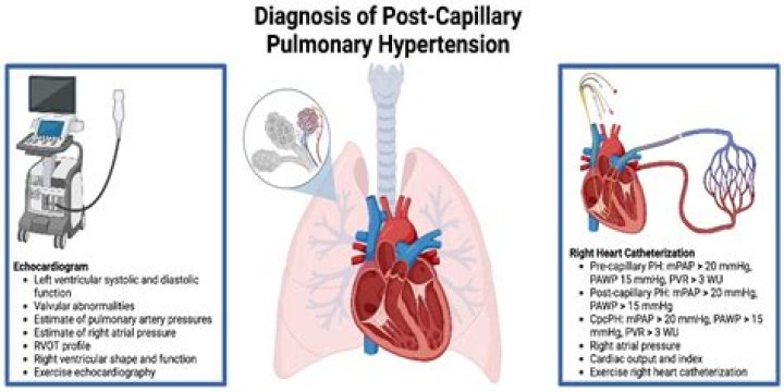 What is pulmonary airflow?