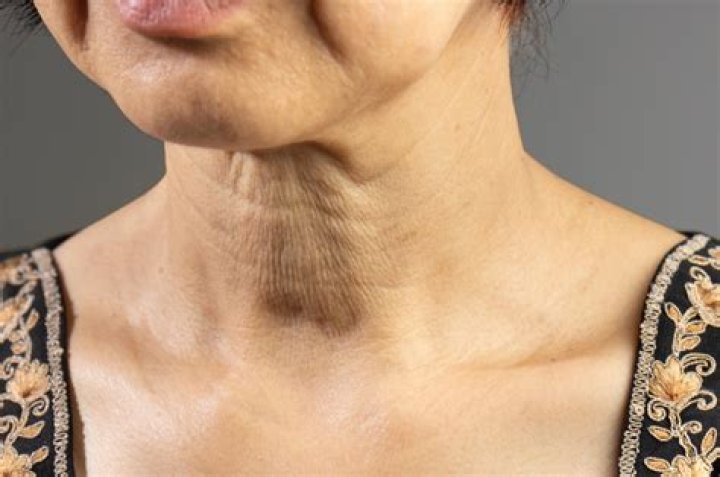 Where does the term neck and neck come from?